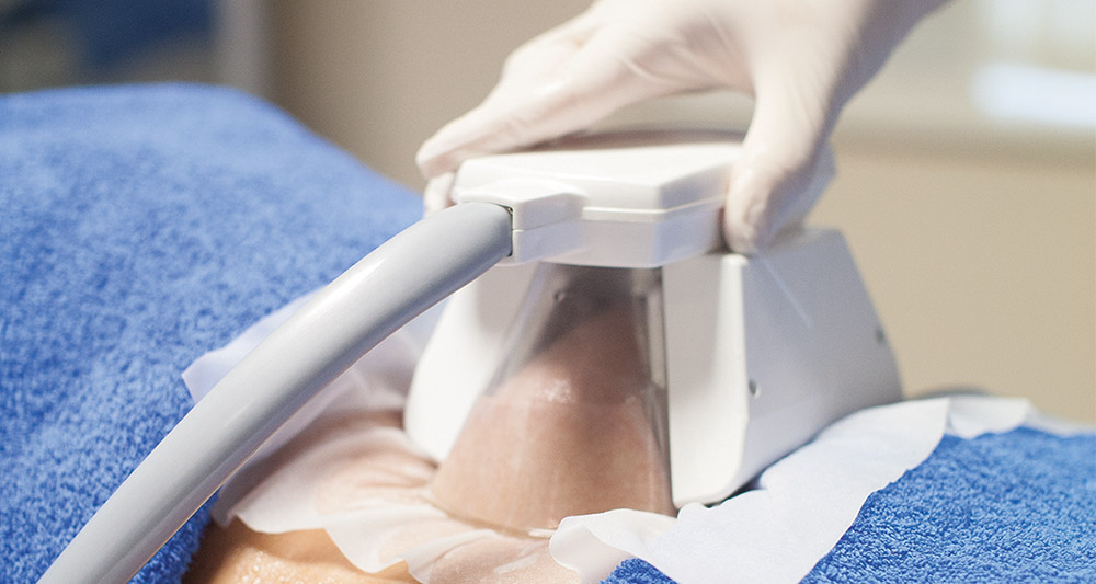 How Fat Freezing and HIFU Work Together? 2 Multiple Areas in One Session HIFU and Fat Freezing Dunstable