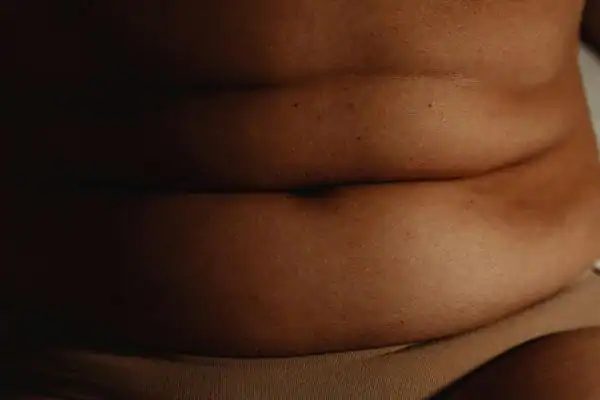 The Hidden Connection: How Stress Shapes Your Fitness and Body Composition 3 image of what stress can do on the stomach area and how Lipo 360 Dunstable can help to change your body shape.