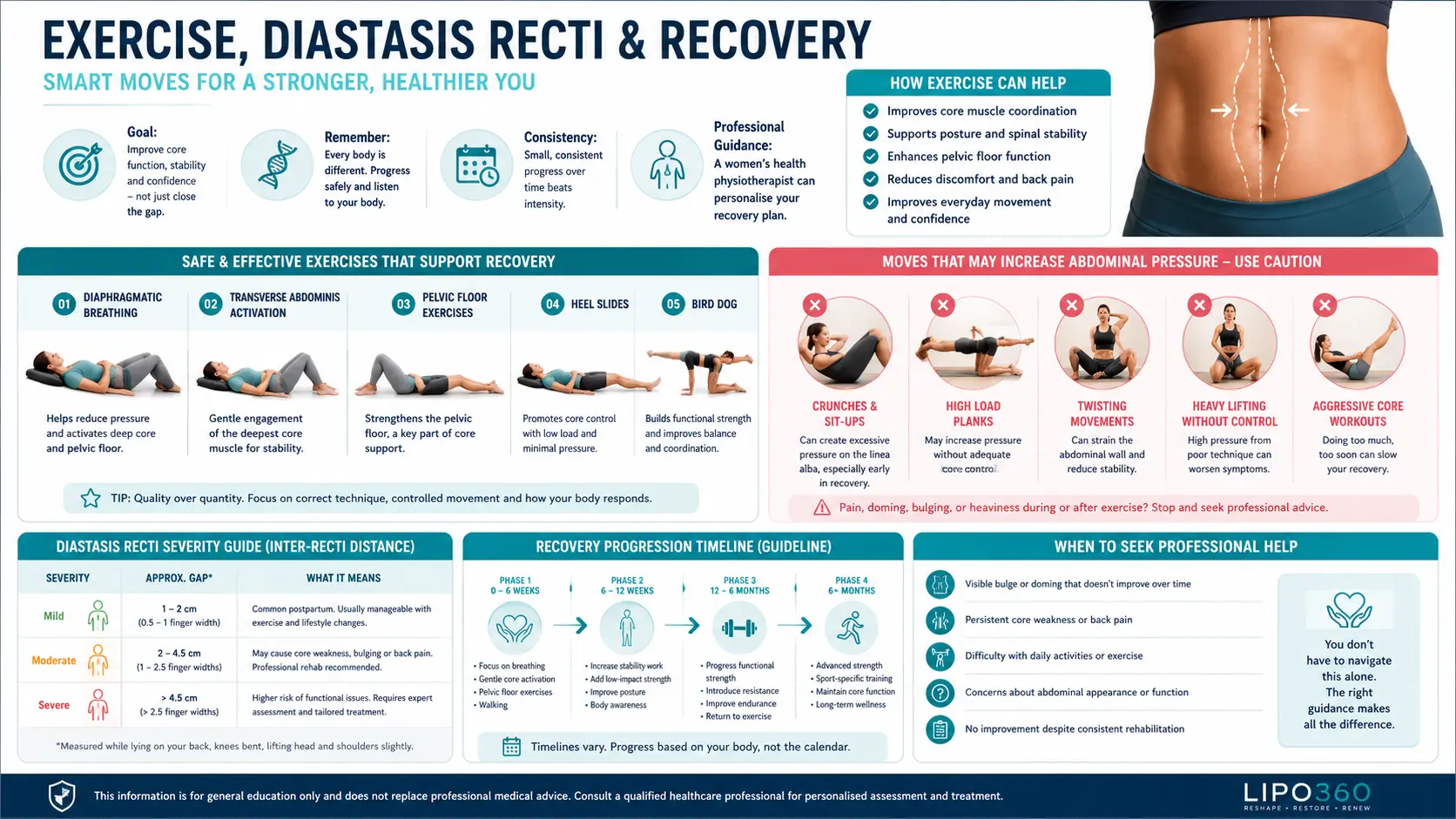 Does Exercise Reduce the Risk of Diastasis Recti? 3 Does Exercise Reduce the Risk of Diastasis Recti?